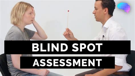blind spot test normal results|Blind Spot Assessment .